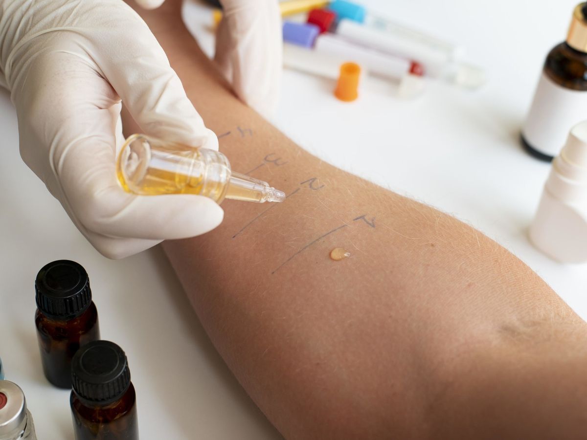 Check-up Allergie